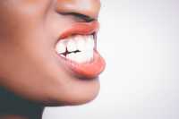 gum disease, dental health