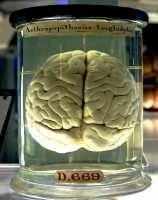 brain-wikipedia-image