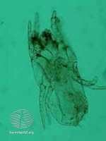 dust-mite-dermnet-nz-image