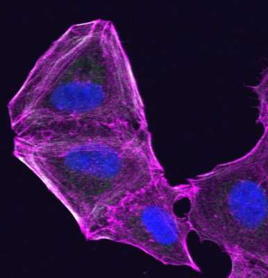 Melanoma Cells Change Their Cytoskeleton to Evade Treatment