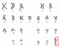 Y Chromosome Image: Wikipedia