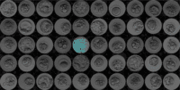 Artificial intelligence can help embryologists during IVF by identifying embryos that have the best chance of success. Image credit: Manoj Kumar Kanakasabapathy