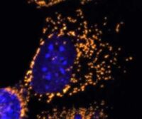 mitochondrial eye disease