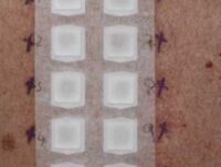 patch-test-series-dermnet-nz-image