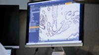 DCISionRT testing process includes advanced analysis of biomarker data from a DCIS patient’s specimen