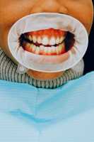 teeth-dentistry-dentist
