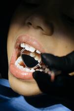 dental-cavities-pediatrics