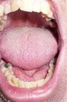 Mouth Holes _ A.Currell _ Flickr