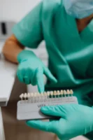 dental-veneers-teeth-dentistry-pexel-image