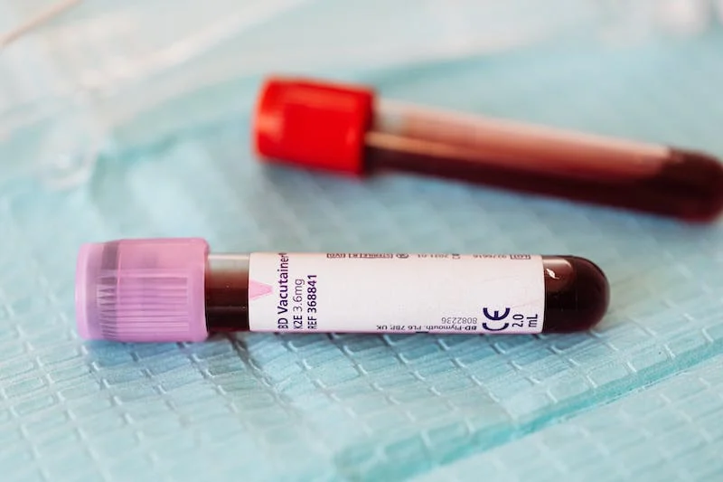blood-laboratory-testing