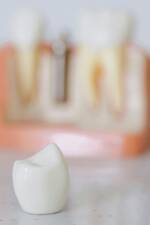 missing-tooth-dental-pexels-cottonbro-6502340