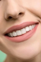 teeth-whitening-dental-dentist