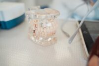dental-crowns-1.jpg