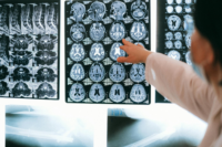 brain-image-speech-therapy.png