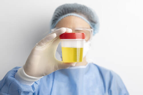 urine testing