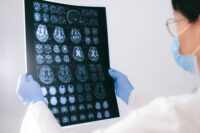 brain-injuries-rehabilitation