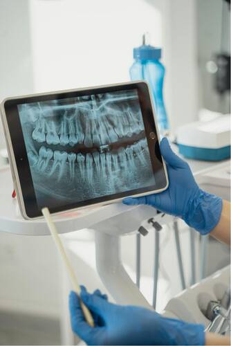 biomimetric dentristy X ray of teeth