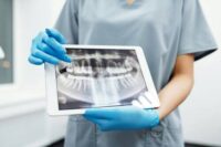 root-canal-dentistry