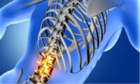 spinal-cord-injuries.jpg