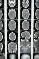 radiology-imaging-ai-medicine