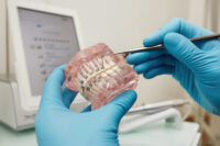 The most common myths about braces debunked