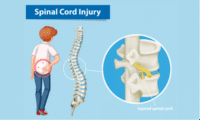 Challenges Faced By Spinal Cord Injury Victims