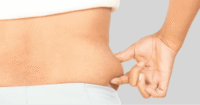 liposuction Enhances Self-Esteem.png