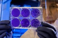 potential-benefits-stem-cells-pain-relief.jpg