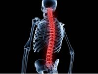 Get Compensation for a Spinal Injury