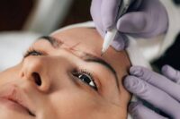 Med Spa Treatments and Facial Aging