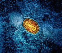 mitochondria_national-institute-of-allergy-and-infectious-diseases-ctqjqnqxny8-unsplash