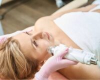re-microneedling-collagen-stimulation.jpg