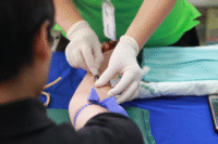 PRP Therapy Explained
