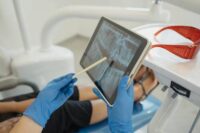 personalized-endodontic-treatment-root-canal