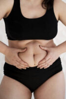 mommy-makeover-atlanta-belly
