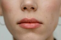 your-skin-deserves-better