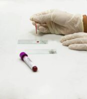 malignant-hematology-laboratories