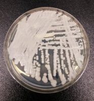 C. auris- CDC image.jpg