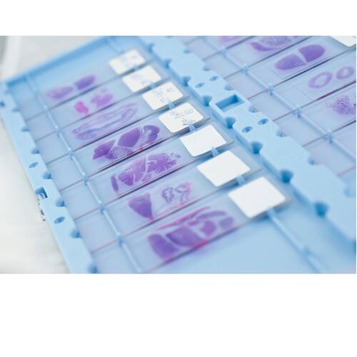 Where Immunohistochemistry Services Add Clarity