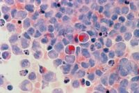 nci-cancer-cells-metabolism.jpg