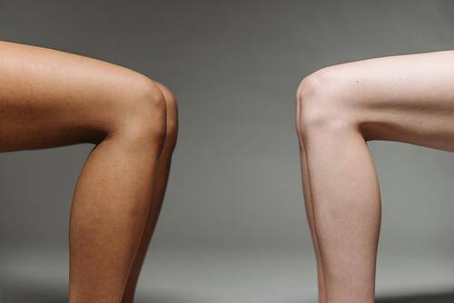 Advances in Minimally Invasive Vein