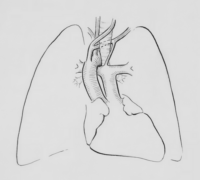 inflammation-factor