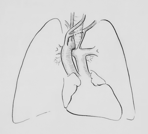inflammation-factor
