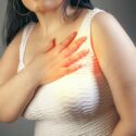 Breast Reduction Surgery Alleviates Chronic Pain