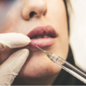 Commonly Asked Questions About Botox