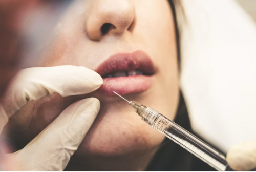 Commonly Asked Questions About Botox