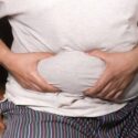 Modern Tummy Tuck Techniques
