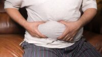 Modern Tummy Tuck Techniques