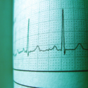 Wearable Heart Monitors-pexels.png