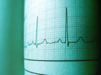 Wearable Heart Monitors-pexels.png
